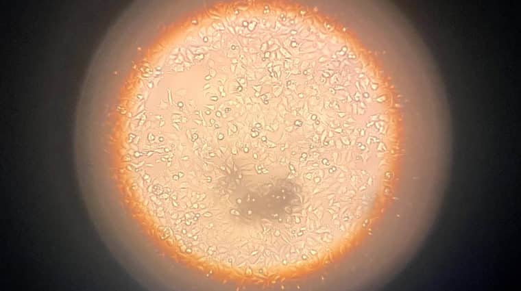 Cells under a microscope.